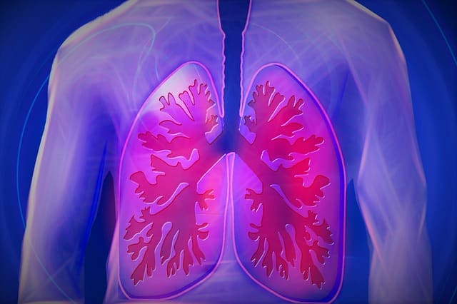akute diffuse infiltrative Lungeninfektion