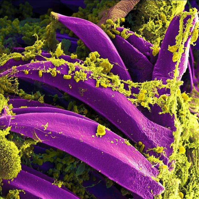 Yersinia pestis – Pestbakterium